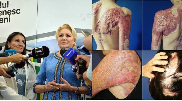 Viorica Dăncilă RĂSPUNDE VICTIMELOR de la Colectiv: „Am primit scrisoarea”