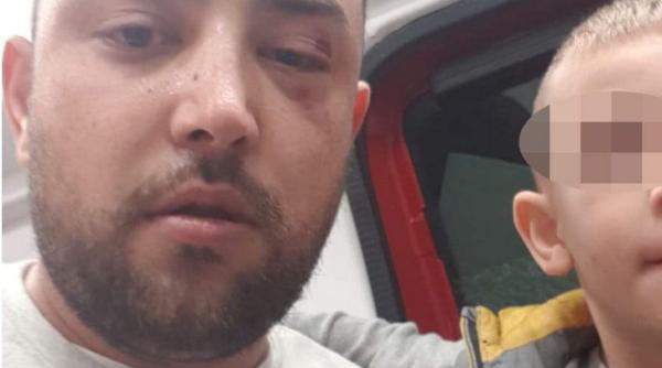 Un copil de trei ani, GAZAT de agenții care i-au BĂTUT tatăl, în Caracal: „Dacă nu fugeam, îmi omorau copilul”