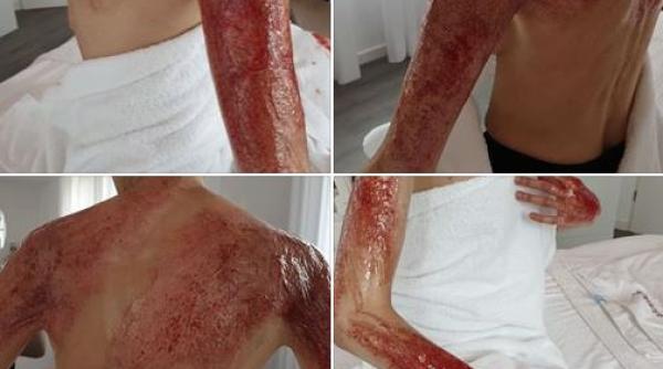 Incendiu COLECTIV. Mesajul unei supraviețuitoare - „4 ani mai târziu: o șansă la SCHIMBARE, ratată. Noi continuăm să ARDEM“