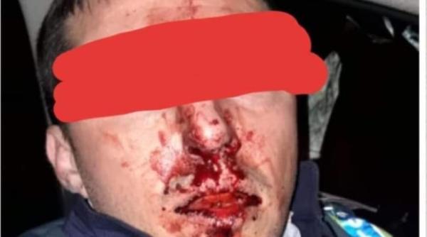 (VIDEO) Polițiști români ATACAȚI! Sindicatul cere ministrului Vela să lase „rebranduirea“: „Trebuie LEGI care corespund REALITĂȚII“