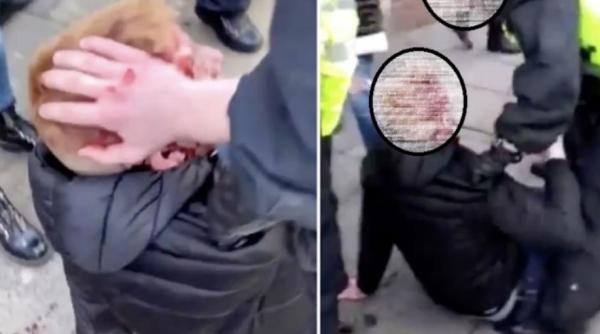 Olanda. Român plin de sânge și cu capul spart sare să bată medici și polițiști: „Lăsați-mă! La dracu'!“