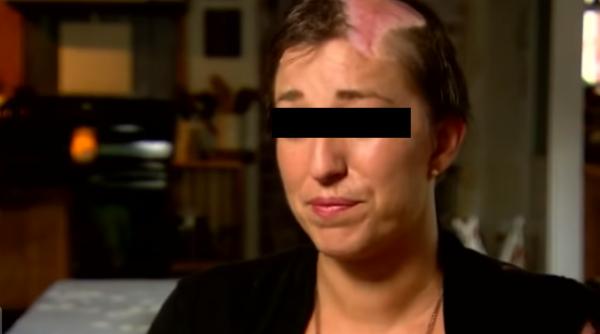 Italia. Tânără româncă, scalpată într-un atelier auto ilegal: Autoritățile NU cred că a fost un accident