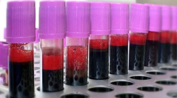 Alertă sanitară: Fiole cu sânge aruncate pe marginea unui drum public