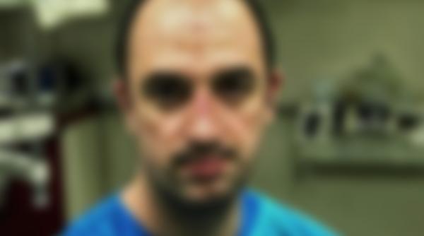 Imaginea unui asistent român după zeci de ore de muncă: obosit și cu semne adânci de la masca de protecție (FOTO)