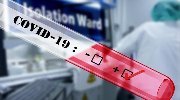 Epidemiolog: „România nu stă bine la capitolul testare”