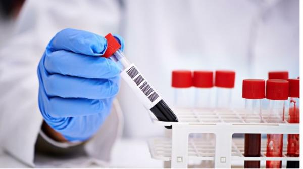 Coronavirus: Circa şase milioane de cazuri de infecţie în întreaga lume. Ţările cu cele multe DECESE