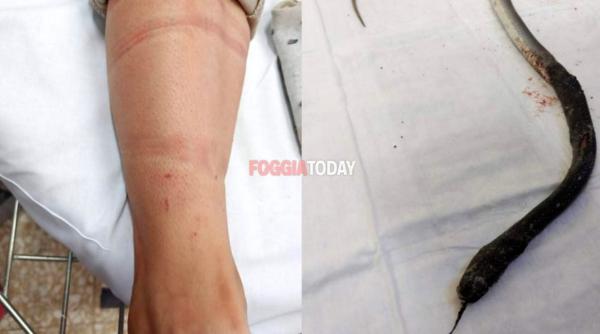 Italia. Româncă, mușcată de un ȘARPE în timp ce culegea pepeni