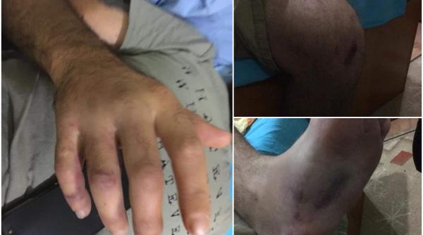 Un bucureștean a fost TORTURAT de polițiști, după ce le-a reproșat că amendează oamenii fără motiv și nu poartă mască - FOTO