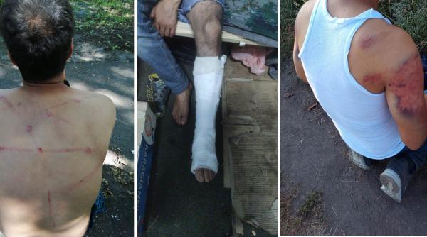 Euronews: Polițiștii de frontieră români acuzați de VIOLENȚĂ, la graniță: „Mi-au luat cârja și m-au bătut cu ea“