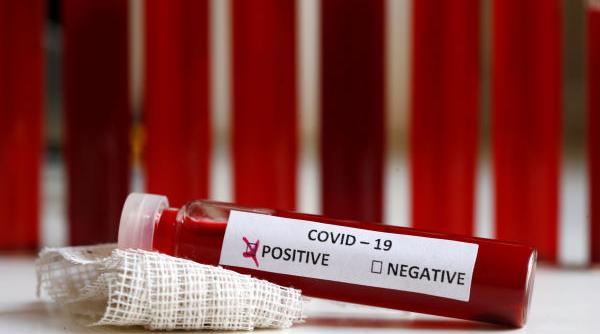 Dosar PENAL pentru un român confirmat cu coronavirus. A mers în trei oraşe diferite pentru a primi rezultatul pe hârtie