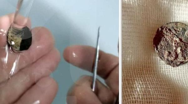 Un bărbat a mers la spital, crezând că are COVID. Medicii au rămas însă şocaţi 