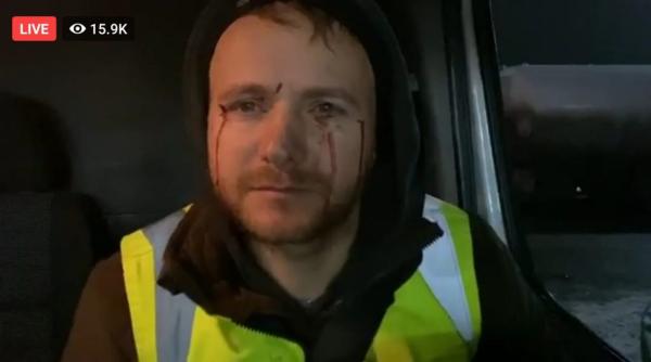 Activistul Daniel Bodnar, plin de sânge. Atacat de tăietorii de lemne: „Voi sunteți asasinii! Mi-am dus familia din România să fie în siguranță“