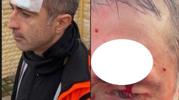 Europarlamentar PSD, rănit după ce a intrat cu bicicleta într-un autoturism: "Am avut ghinion şi noroc în aceeaşi fracţiune de secundă!" (FOTO)