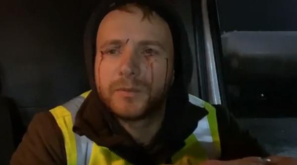 Activistul Daniel Bodnar, primul mesaj după accident: „Piciorul stâng nu-l simt. Puteam să mor“ 