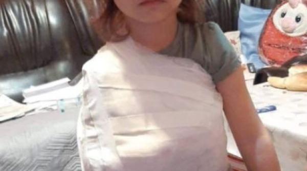 Caz șocant într-un spital din România: fetiță cu fractură, bandajată de medic peste tricou