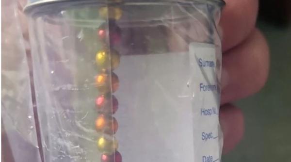 Marea Britanie: O fetiță, în stare critică, după ce a înghițit 14 magneți. Credea că sunt dulciuri