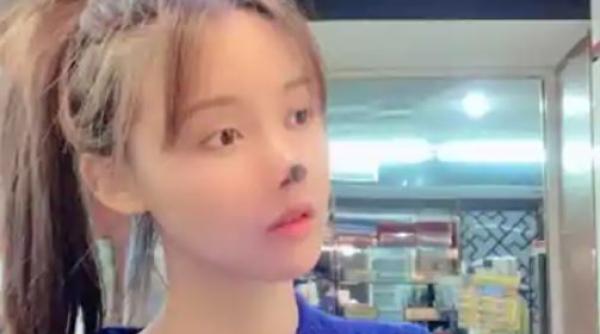 Actriță celebră din China, cu nasul distrus după o operație greșită: „A necrozat”