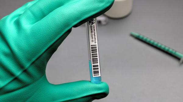 Italia. Teste rapid care identifică trei tulpini Covid în două ore