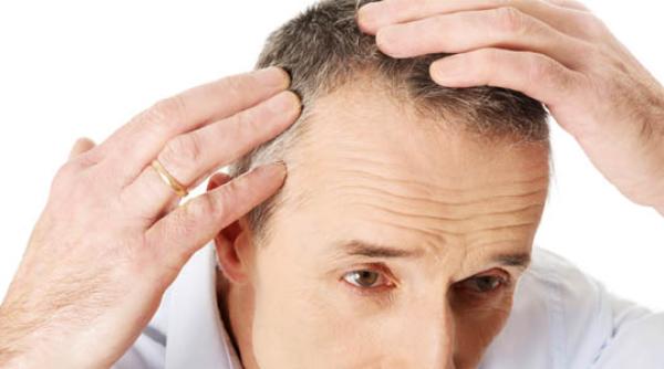 Schimbări în turismul medical pe timp de pandemie. Unde merg românii pentru transplant de păr