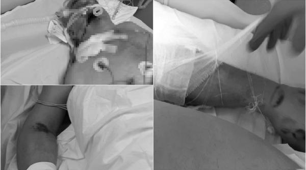 Asistentă la Spitalul din Sibiu, noi mărturii: „Am văzut cum se omoară oameni prin sedare. Se miza pe cei fără aparținători”