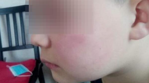 Băieţel de 7 ani, bătut de tatăl unei colege, sub privirile îngrozite ale învățătoarei