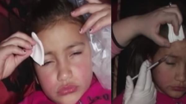 O mamă inconștientă și-a injectat fetița de doar opt ani cu botox. Cum și-a explicat femeia gestul