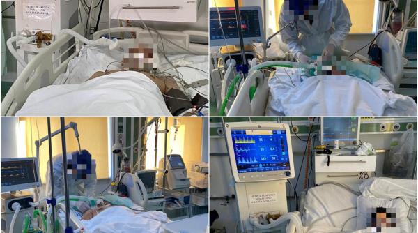 Un manager de spital publică imagini din ATI: "Unii protestatari vor supraviețui, alții nu" - GALERIE FOTO