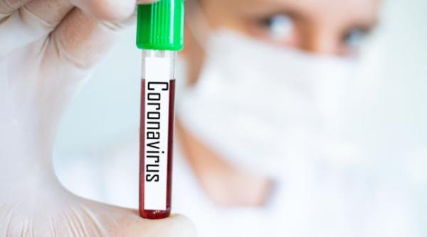 Germania. Autorităţile vor obliga firmele să le ofere angajaţilor teste COVID-19. Testele, plătite de angajatori