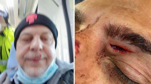 Italia. Patru polițiști au ajuns la spital, după ce au fost bătuți de un român. Victimă: Atacatorul era un pachet de nervi, era greu să-l oprești 