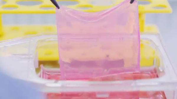 Premieră medicală. Piele pentru transplanturi, produsă de un aparat deținut de Elveția