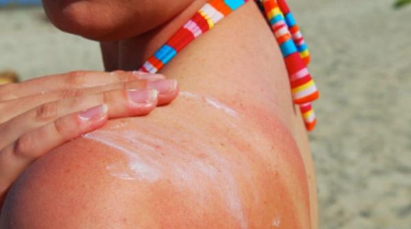 Cum să nu te arzi la soare. Greșeli care trebuie evitate imediat