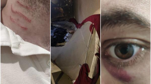 Spania. Deținut român, la un pas să arunce penitenciarul în aer: A iscat un incendiu în carceră, pentru a fi dus la spital „să vadă asistentele“