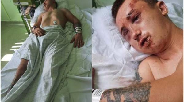 Monștrii sunt printre noi. Tânăr bătut, mutilat, tâlhărit, dezbrăcat și abandonat într-o baltă de sânge pe trotuar