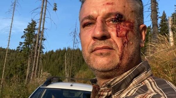 Activistul de mediu Tiberiu Boșutar, întâlnire cu Florin Cîțu după ce a fost bătut în Suceava: ”Categoric îmi este teamă pentru țara asta“