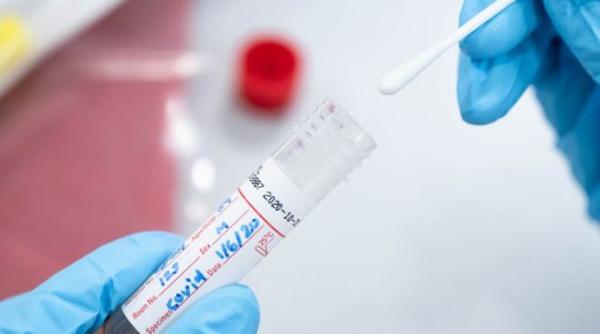 Austria, decizie de ultimă oră: Testele pentru Coronavirus rămân gratuite până în primăvară