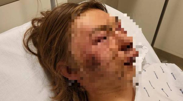 Belgia. Tânăr de 15 ani, desfigurat pentru că se întâlnea cu o adolescentă cecenă: „L-au linșat, au vrut să-i taie gâtul”