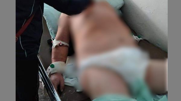 Român internat cu piciorul rupt, mort de pneumonie în spital: „L-au ținut o săptămână cu piciorul rupt, oasele scoase afară, și sângera“