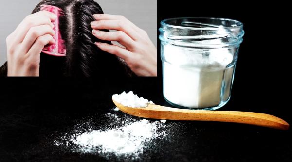 Cum să îndepărtezi mătreața cu bicarbonat de sodiu. Trucul pe care neapărat trebuie să-l știi!
