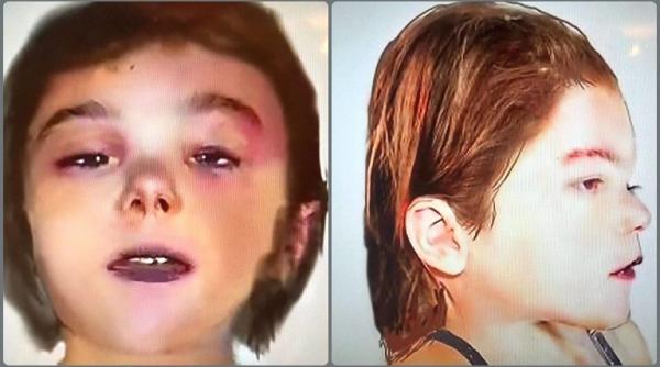 Fetița incendiată lângă cimitir, în Arad, a fost identificată