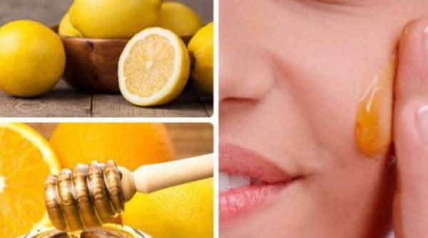 Combină suc de lămâie cu o linguriță de miere și aplică pe ten. Remediul minune, care te scapă de petele pigmentare