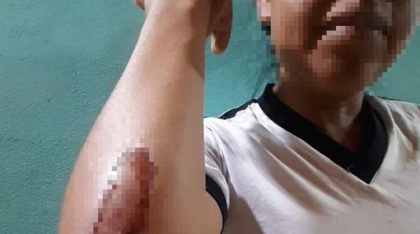 De frica soțului român, care o maltrata, a sărit de pe o motocicletă în mers. Carolina: „Mi-a spus ca o să mă omoare, că nu-mi voi recupera fiul”