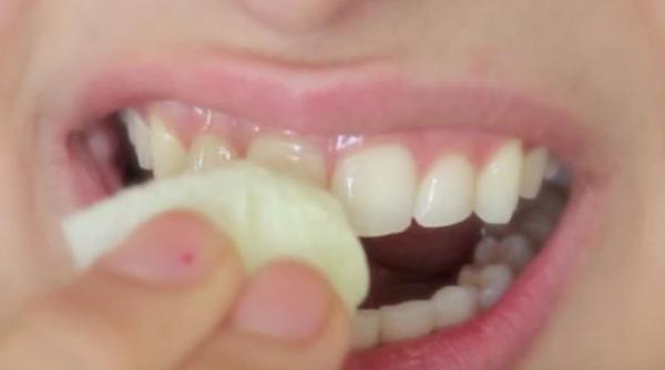 Un remediu natural ne albește dinții în câteva clipe. Bicarbonatul de sodiu rămâne o amintire