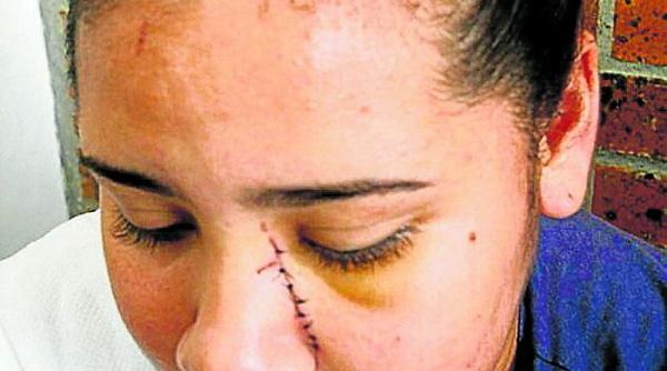 Italia. O româncă i-a tăiat fața fața unei moldovence cu un pahar, din cauza unei fotografii în care nu i-a plăcut cum arată