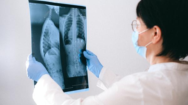 Reputat profesor doctor român: Facem radiologi foarte buni în România, nu avem puterea să-i ţinem în ţară