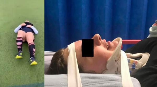 O adolescentă de 16 ani s-a ales cu gâtul rupt, după provocarea „skull breaker“ de pe TikTok: „Nu am vrut, dar au fost presiune din partea colegilor“