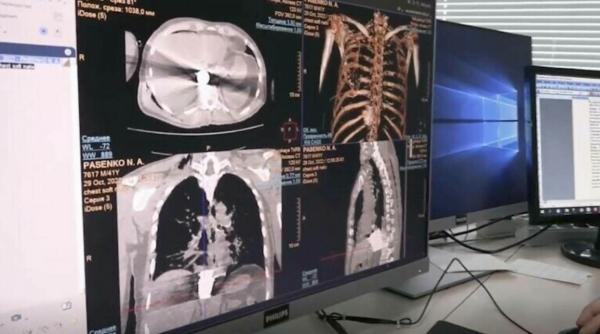 Medicii ruși au scos din pieptul unui soldat o bombă ucraineană neexplodată