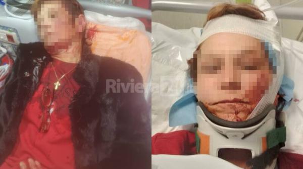 Italia. Cuplu de români, în stare gravă după ce au fost bătuți de concubinul fiicei: „Mă amenințase deja în trecut: voia să mă omoare“