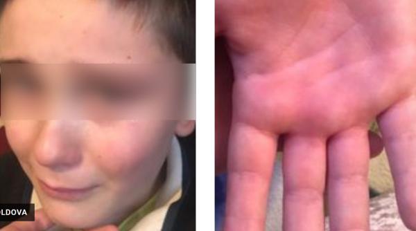 Învățătorul care a bătut un copil că nu știa tabla înmulțirii, lăudat de primar: „I-aș strânge mâna. Bătaia e ruptă din Rai!“