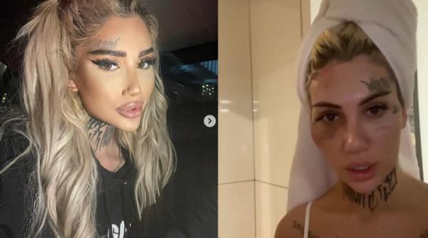 Bia Khalifa susține că a fost bătută de poliție: „Aici sunt umflată și vânătă” FOTO