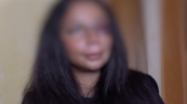 Italia. Tânără, agresată de doi bărbați cu cagule în drum spre casă: "Au vrut să mă marcheze“